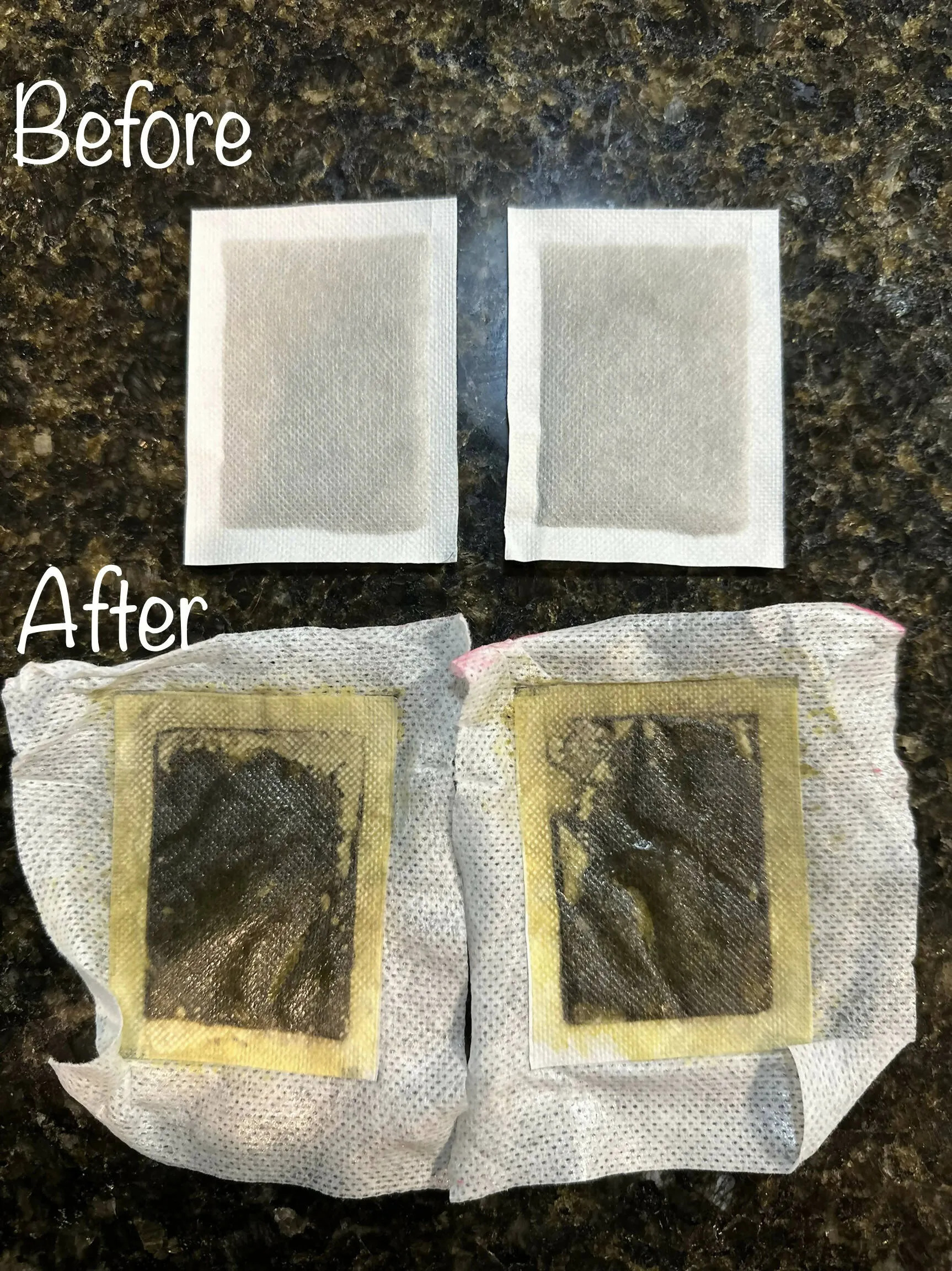 Detox Foot Pads